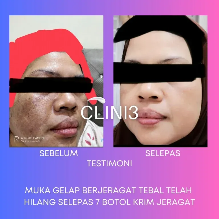Testimoni Clini3