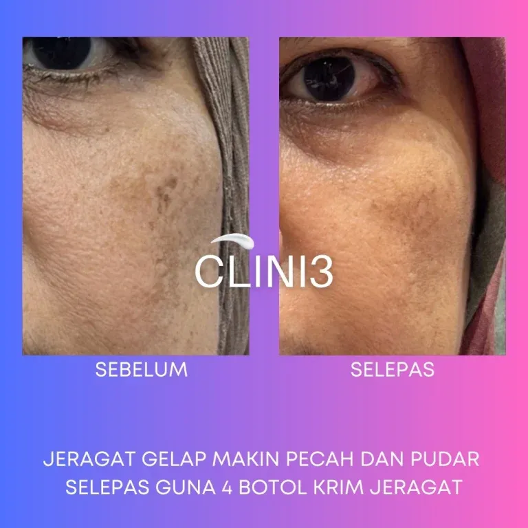 Testimoni Clini3