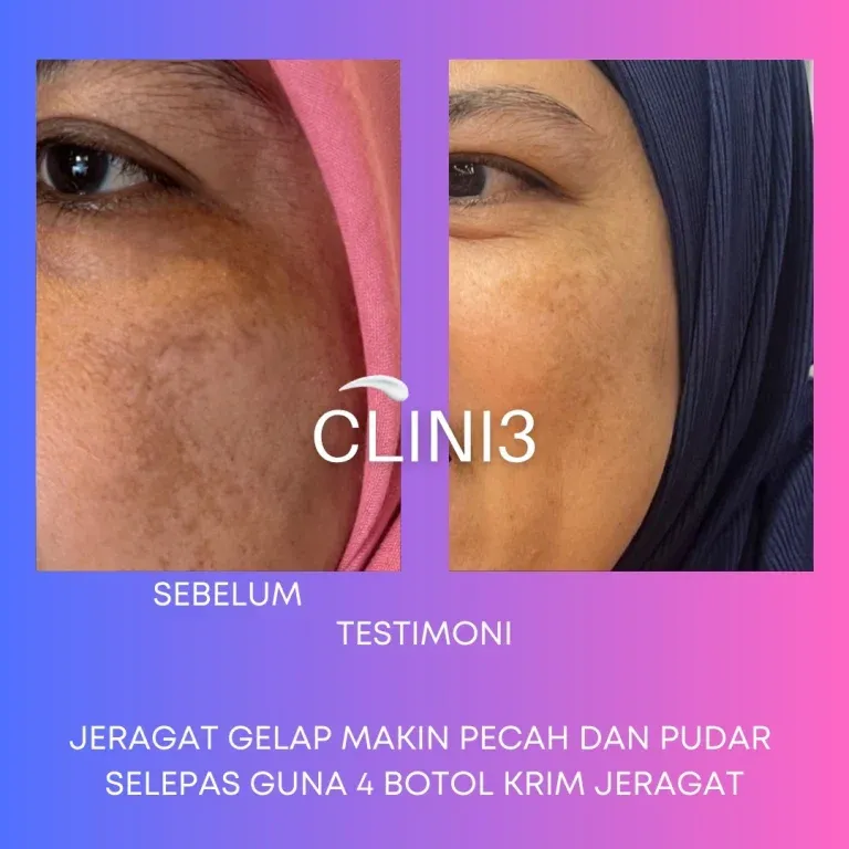 Testimoni Clini3