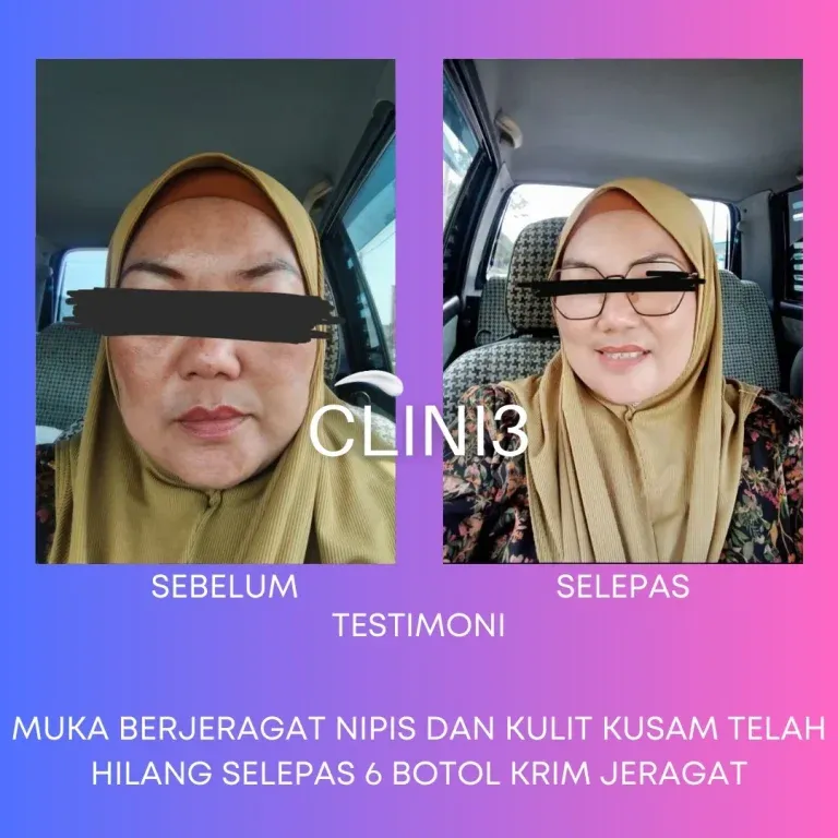Testimoni Clini3