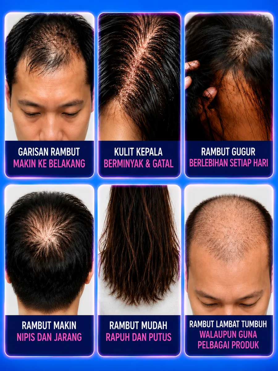 Rambut gugur di lantai