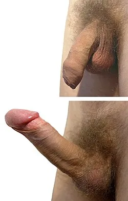 Keras